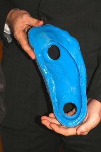 Synthetic material created by the SYNSkin Team to help diabetic patients with foot ulcers is shown. 
